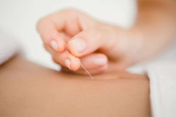 Sydney Massage and Acupuncture