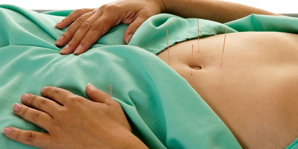 fertility acupuncturist